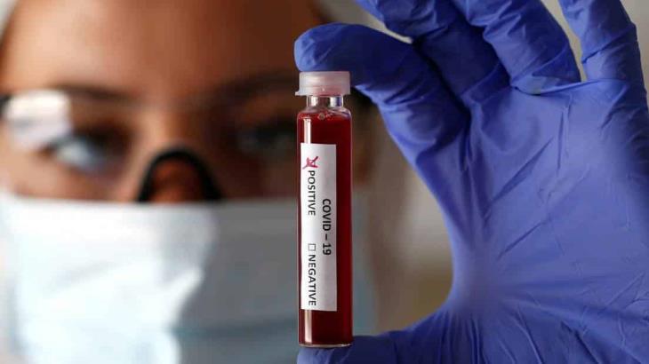 Confirma Secretaría de Salud quinto caso positivo de coronavirus en Tabasco Confirma Secretaría de Salud quinto caso positivo de coronavirus en Tabasco