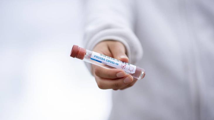 Registra Salud 87 nuevos contagios de coronavirus en Tabasco; defunciones suman 3 mil 102 Registra Salud 87 nuevos contagios de coronavirus en Tabasco; defunciones suman 3 mil 102