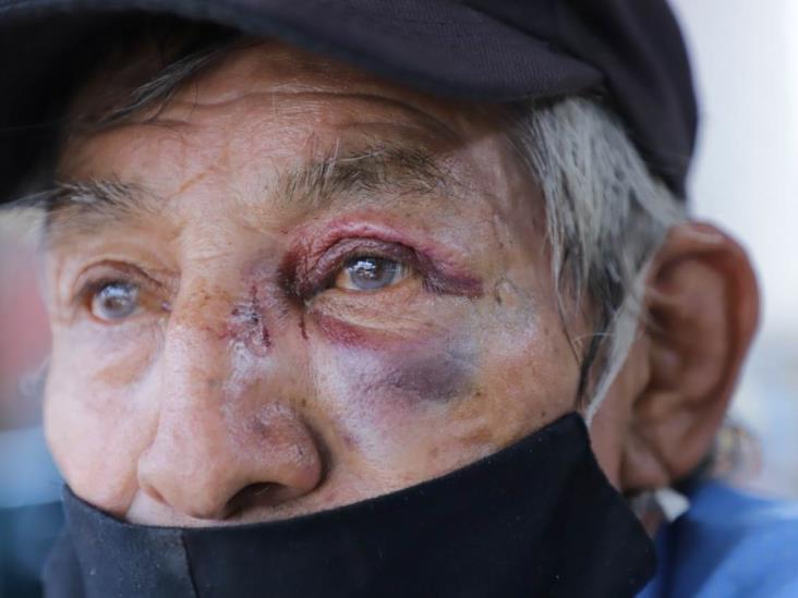 Asaltan y golpean a Don Javier, el abuelito vende dulces de Tierra Colorada Asaltan y golpean a Don Javier, el abuelito vende dulces de Tierra Colorada